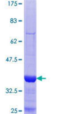 SDS-Page: Recombinant Human CRMP2 Protein [H00001808-Q01] - 12.5% SDS-PAGE Stained with Coomassie Blue.