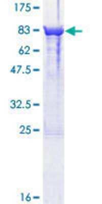 12.5% SDS-PAGE Stained with Coomassie Blue.