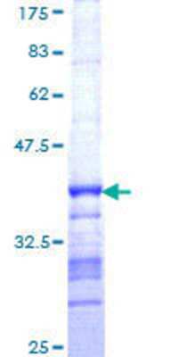 12.5% SDS-PAGE Stained with Coomassie Blue.