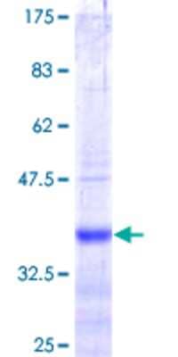 12.5% SDS-PAGE Stained with Coomassie Blue.