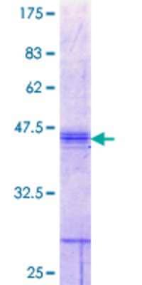 SDS-Page: Recombinant Human SLC26A2 Protein [H00001836-Q01] - 12.5% SDS-PAGE Stained with Coomassie Blue.