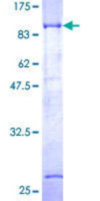 12.5% SDS-PAGE Stained with Coomassie Blue.