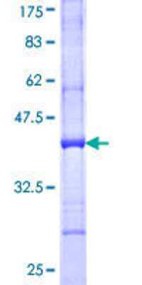 12.5% SDS-PAGE Stained with Coomassie Blue.
