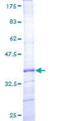 SDS-Page: Recombinant Human DTX1 Protein [H00001840-Q01] - 12.5% SDS-PAGE Stained with Coomassie Blue.