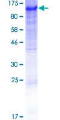 12.5% SDS-PAGE Stained with Coomassie Blue.