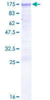 SDS-PAGE Recombinant Human Dishevelled-3 GST (N-Term) Protein