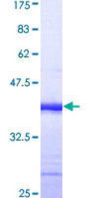 SDS-Page: Recombinant Human Dishevelled-3 Protein [H00001857-Q01] - 12.5% SDS-PAGE Stained with Coomassie Blue.
