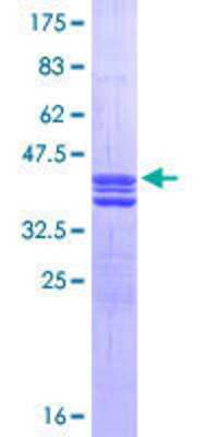 12.5% SDS-PAGE Stained with Coomassie Blue.