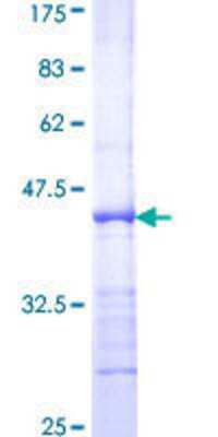 12.5% SDS-PAGE Stained with Coomassie Blue.