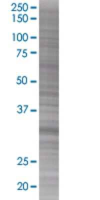 E2F6 transfected lysate