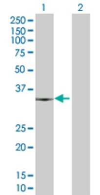 Lane 1: E2F6 transfected lysate (31.8 KDa). Lane 2: Non-transfected lysate.