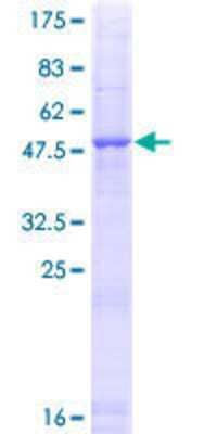 12.5% SDS-PAGE Stained with Coomassie Blue.