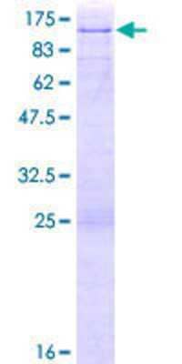 SDS-PAGE Recombinant Human E74 like factor 1 GST (N-Term) Protein