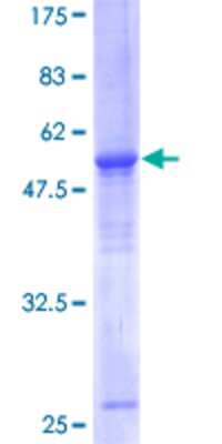 12.5% SDS-PAGE Stained with Coomassie Blue.