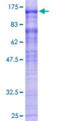 SDS-Page: Recombinant Human EML1 Protein [H00002009-P01] - 12.5% SDS-PAGE Stained with Coomassie Blue.