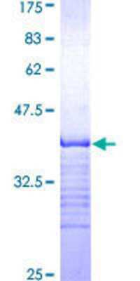 SDS-Page: Recombinant Human MARK2 Protein [H00002011-Q01] - 12.5% SDS-PAGE Stained with Coomassie Blue.