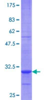SDS-Page: Recombinant Human EMP3 Protein [H00002014-Q02] - 12.5% SDS-PAGE Stained with Coomassie Blue.