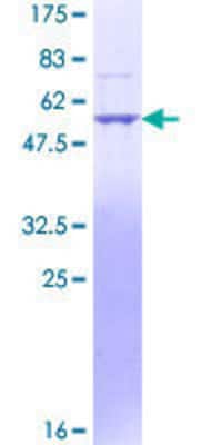 12.5% SDS-PAGE Stained with Coomassie Blue.