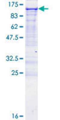 12.5% SDS-PAGE Stained with Coomassie Blue.