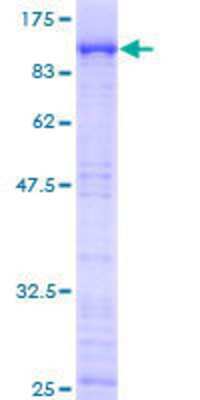 12.5% SDS-PAGE Stained with Coomassie Blue.