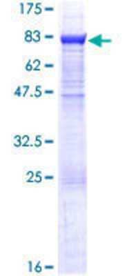 Other Recombinant Human EPHX2 GST (N-Term) Protein