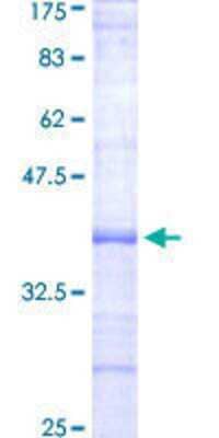 Other Recombinant Human EPHX2 GST (N-Term) Protein