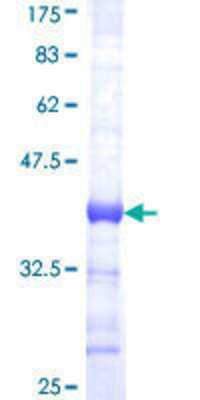 SDS-Page: Recombinant Human ERF Protein [H00002077-Q01] - 12.5% SDS-PAGE Stained with Coomassie Blue.