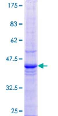 12.5% SDS-PAGE Stained with Coomassie Blue.