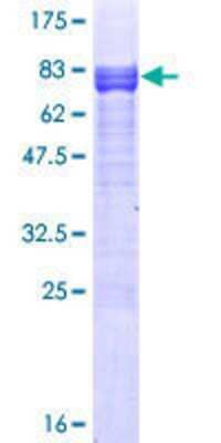 12.5% SDS-PAGE Stained with Coomassie Blue.