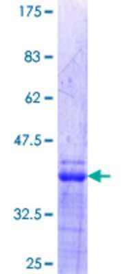 12.5% SDS-PAGE Stained with Coomassie Blue.