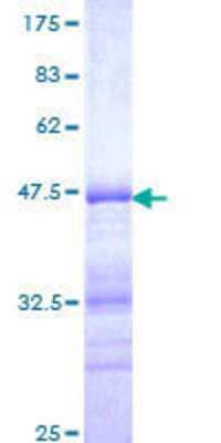 12.5% SDS-PAGE Stained with Coomassie Blue.