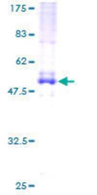 SDS-PAGE Recombinant Human EVI2A GST (N-Term) Protein