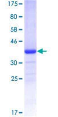 12.5% SDS-PAGE Stained with Coomassie Blue.