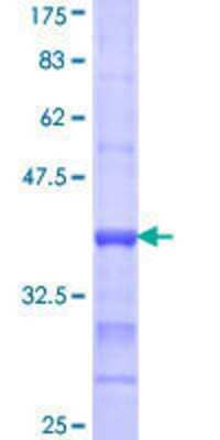 SDS-Page: Recombinant Human ACSL1 Protein [H00002180-Q01] - 12.5% SDS-PAGE Stained with Coomassie Blue.