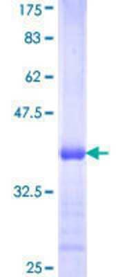 SDS-PAGE Recombinant Human ACSL3 GST (N-Term) Protein