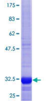 12.5% SDS-PAGE Stained with Coomassie Blue.