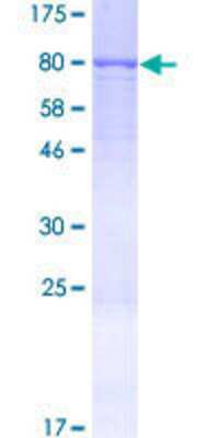 12.5% SDS-PAGE Stained with Coomassie Blue.