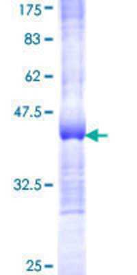12.5% SDS-PAGE Stained with Coomassie Blue.