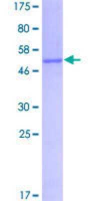 Unknown Recombinant Human FHL1 GST (N-Term) Protein