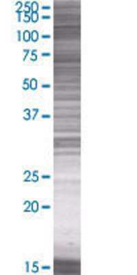 FOXJ1 transfected lysate.