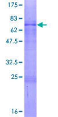 12.5% SDS-PAGE Stained with Coomassie Blue.
