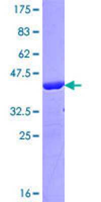 SDS-Page: Recombinant Human AFF2 Protein [H00002334-Q01] - 12.5% SDS-PAGE Stained with Coomassie Blue.