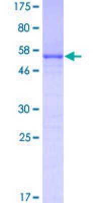 12.5% SDS-PAGE Stained with Coomassie Blue.