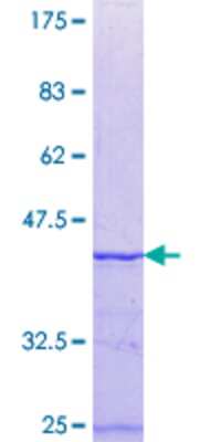 SDS-Page: Recombinant Human FRG1 Protein [H00002483-Q01] - 12.5% SDS-PAGE Stained with Coomassie Blue.