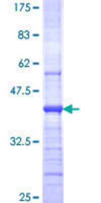 SDS-Page: Recombinant Human CENPI Protein [H00002491-Q01] - 12.5% SDS-PAGE Stained with Coomassie Blue.