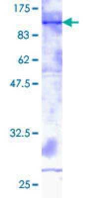 12.5% SDS-PAGE Stained with Coomassie Blue.