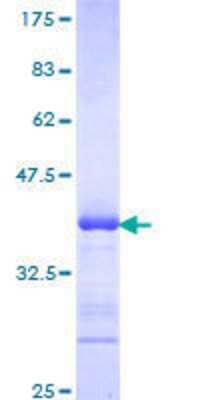 12.5% SDS-PAGE Stained with Coomassie Blue.