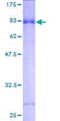 12.5% SDS-PAGE Stained with Coomassie Blue.