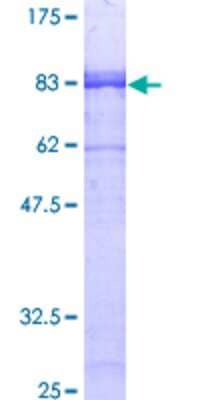 12.5% SDS-PAGE Stained with Coomassie Blue.