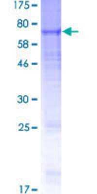 Recombinant Human GABA-A R beta 2 Protein [H00002561-P01] - 12.5% SDS-PAGE Stained with Coomassie Blue.
